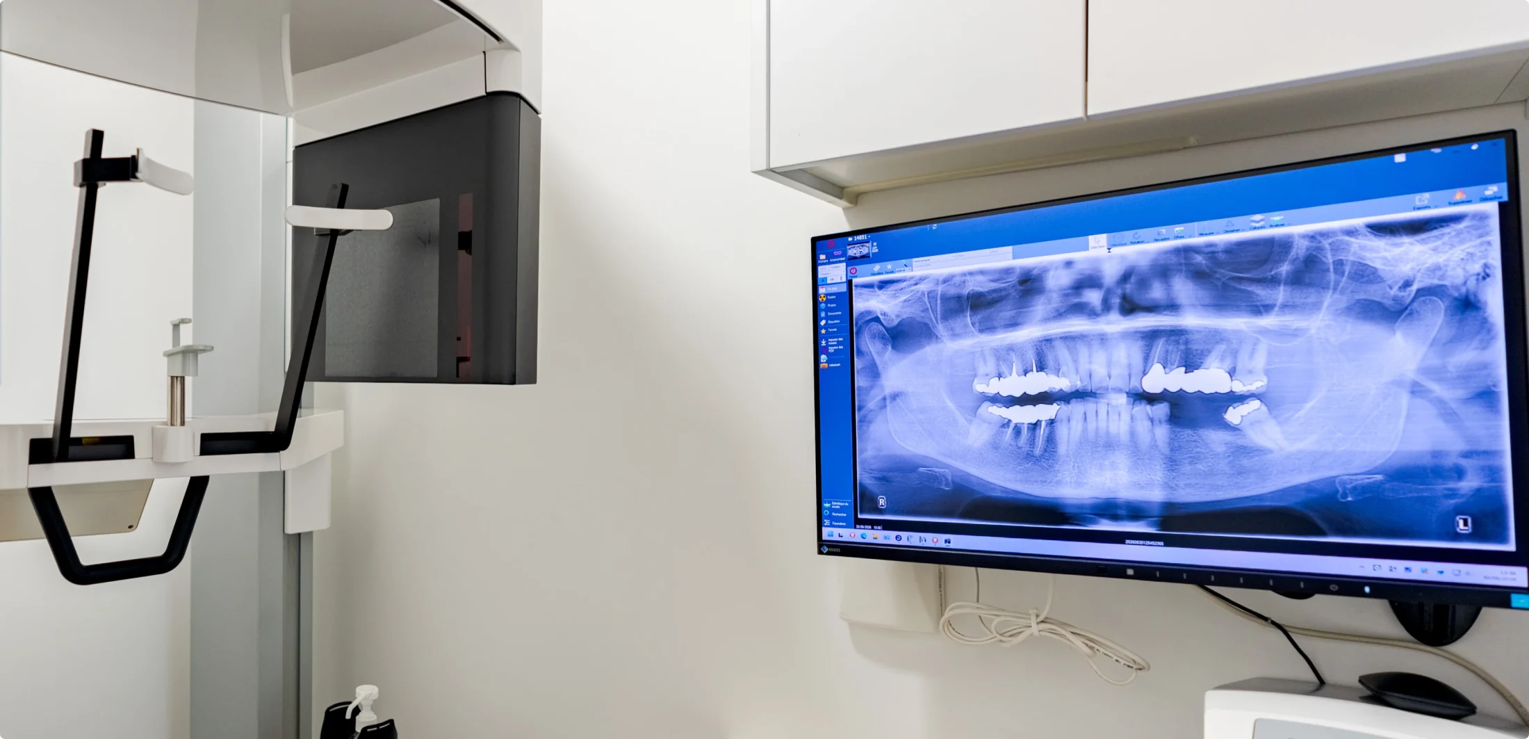 Radiographie panoramique dentaire affichée à l’écran, à côté de Cone Beam